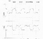 PECL clock,38MHz,group1