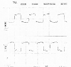 PECL clock,20MHz,group7