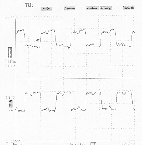 PECL clock,38MHz,group7