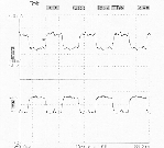 PECL clock,38MHz,group2