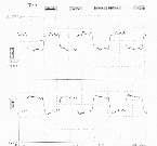 PECL clock,38MHz,group4