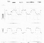 PECL clock,38MHz,group5