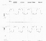 PECL clock,20MHz,group6